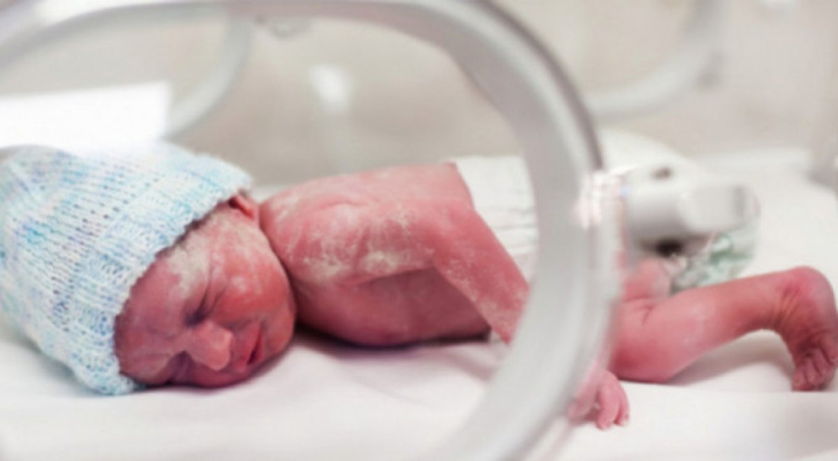 17 Kasım Dünya Prematüre Günü: Prematüre bebekler hakkında 7 bilgi #2