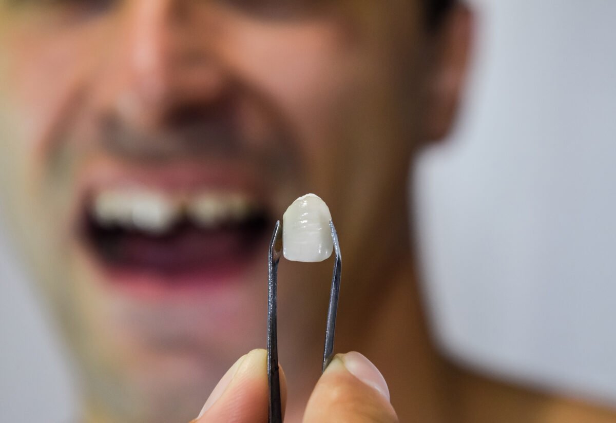 Tedavi edilmeyen diş kırıkları apseye neden oluyor #1