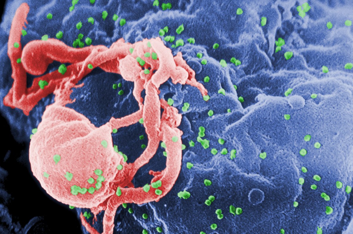 1 Aralık Dünya AIDS Günü: AIDS nedir, belirtileri nelerdir? #1