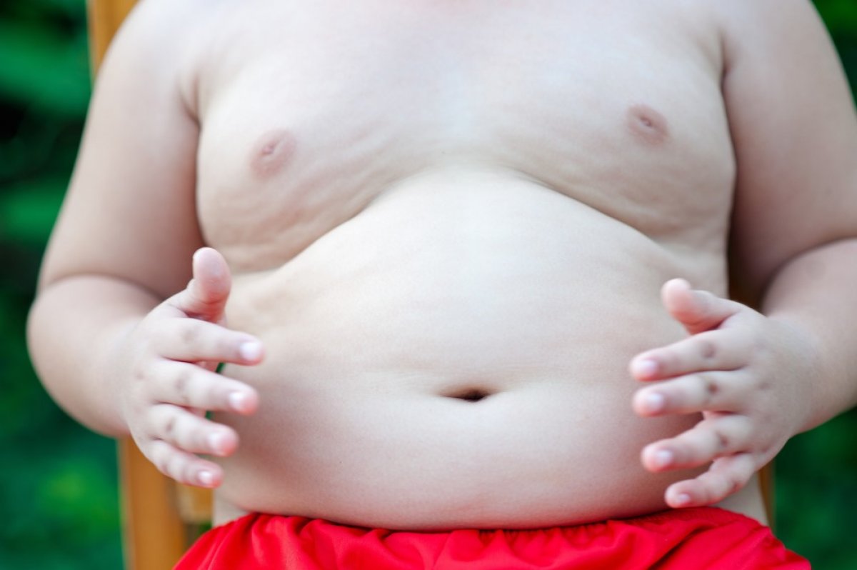 Çocuklarda obezitenin sağlığa etkileri #1