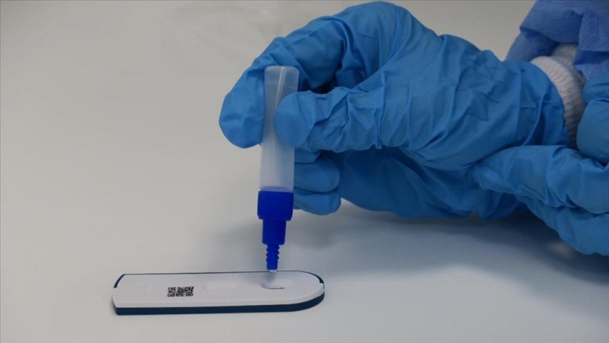 Covid-19 antijen testi ile PCR testi karşılaştırıldı #1