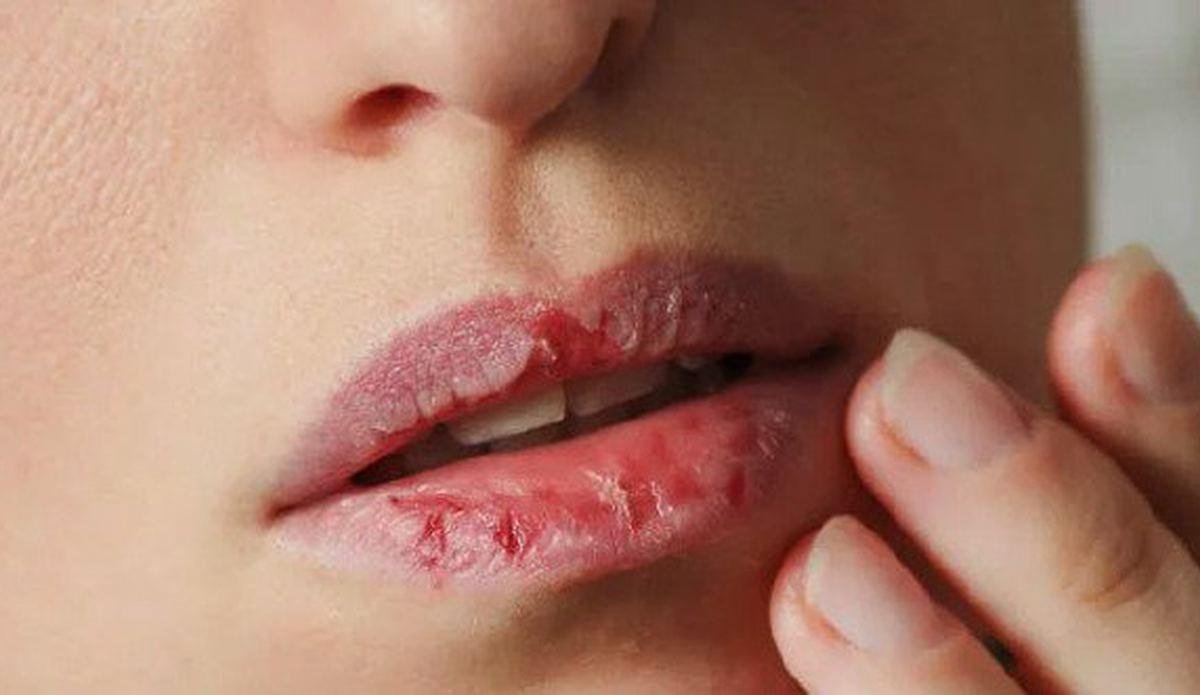 Daha çekici daha kırmızı ve daha sağlıklı dudakların sırrına: Merhaba #6