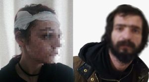 İstanbul'da üniversiteli genç kıza taşla saldırdı, serbest kaldı
